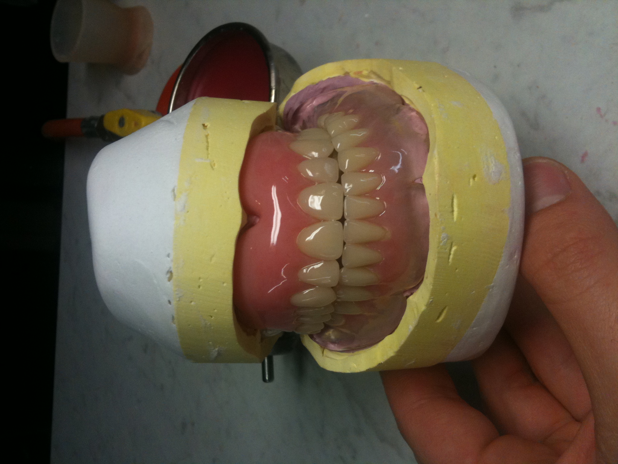 Finished upper and lower full dentures on a dental model